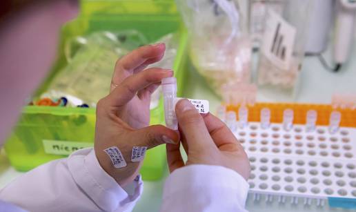 &Scaron;okantno otkri&cacute;e! Ova bakterija otporna je na deset antibiotika: 'Predstavlja nam i prijetnju...'