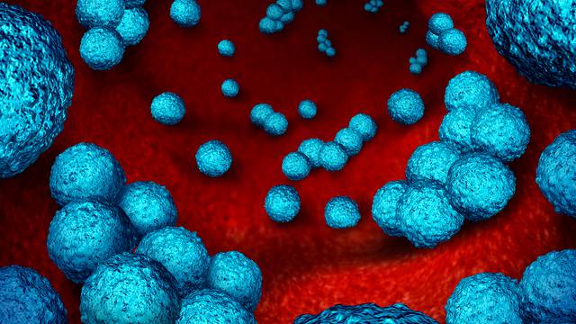Sve više novih slučajeva zaraze opasnom bakterijom otpornom na antibiotike: Brzo se širi