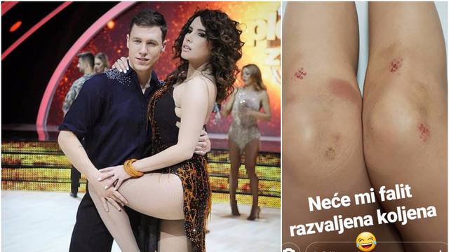 Pokazala je rane nakon plesa: Neće mi faliti razbijena koljena