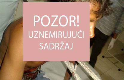 Šipke mu probile vrat i leđa: "Preplavio me osjećaj smrti..."