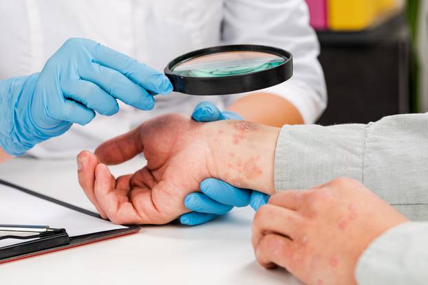 A,Dermatologist,Wearing,Gloves,Examines,The,Skin,Of,A,Sick