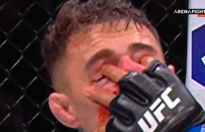 VIDEO Ovo je usporena snimka nesportskog poteza UFC borca!