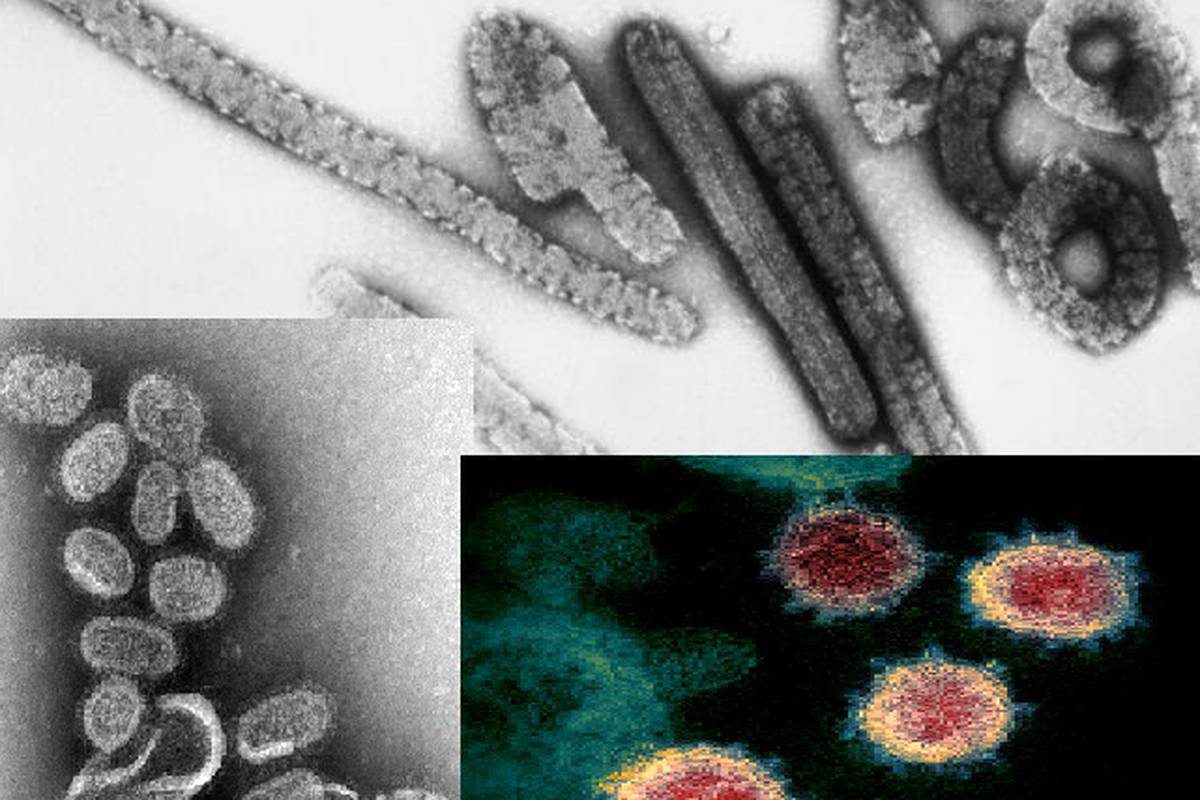 Top 12 najsmrtonosnijih virusa modernog doba - prijetnja su