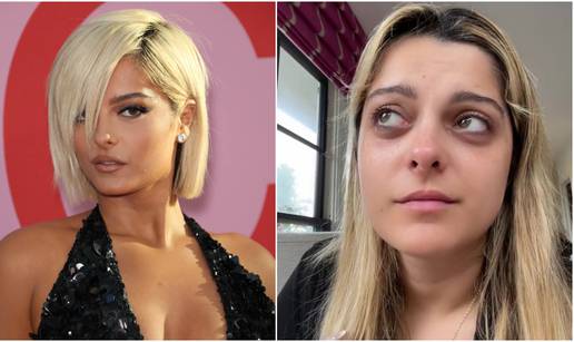 Bebe Rexha zabrinula fanove: 'Nikad nisam bila teža, osjećam se odvratno u vlastitom tijelu!'