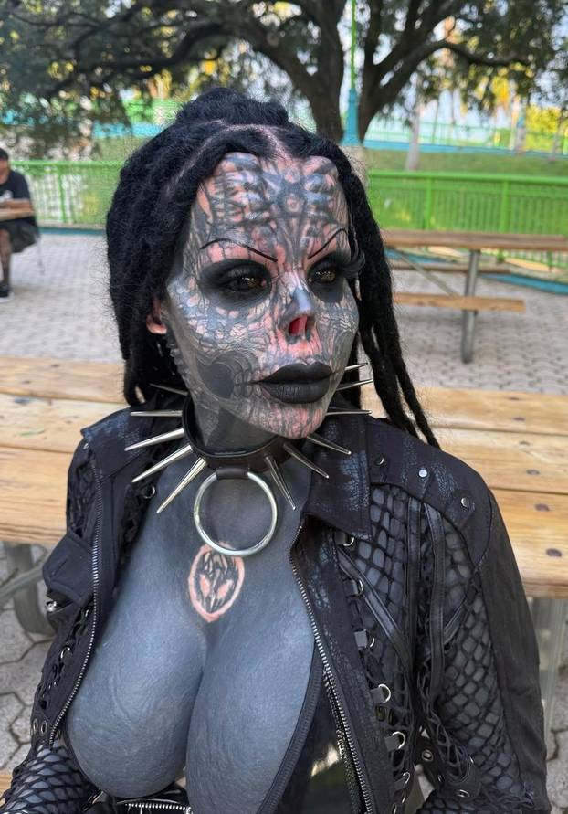 FOTO Uznemirujuće! Uklonila je čak i vrh nosa, a evo kako je izgledala: Šteta, ljepotica si bila