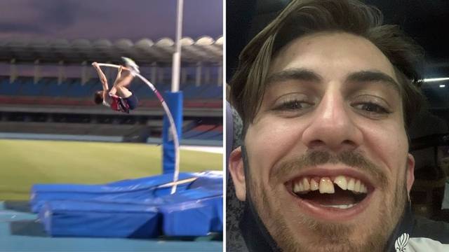 VIDEO Britanac dobio suvenir s Olimpijskih igara. Vlastiti zub