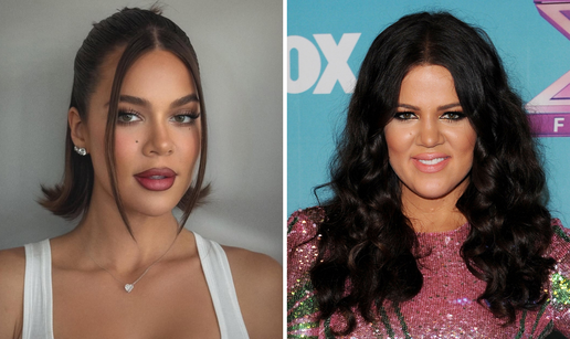 FOTO Kardashianka otkrila što je sve radila na sebi: Operirala nos, a koristi i riblju spermu...