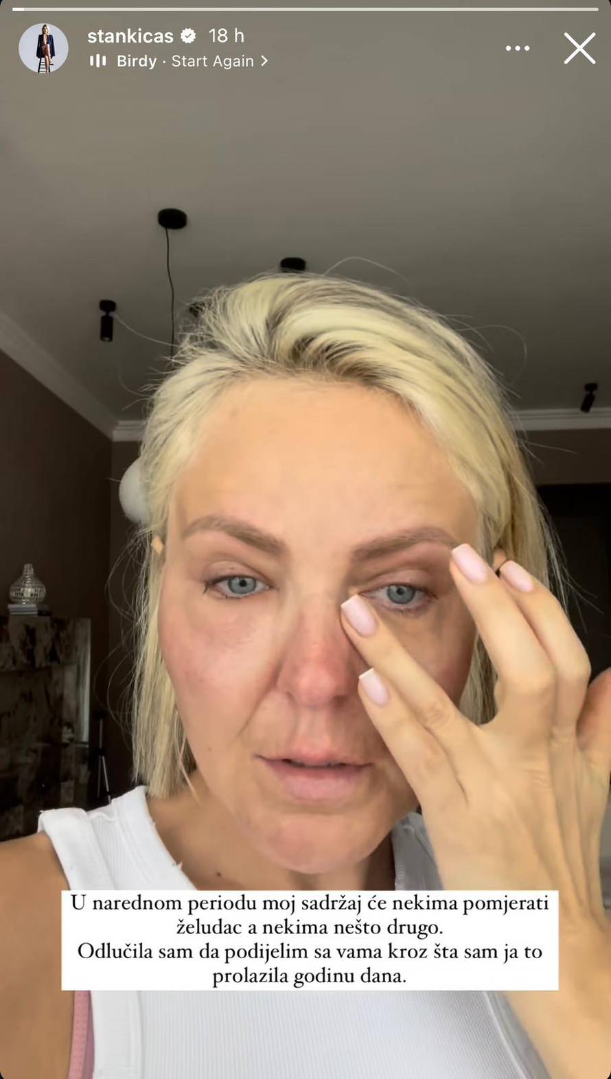 Stankica iz 'Savršenog' nakon traume zbog filera napravila neočekivani životni zaokret...