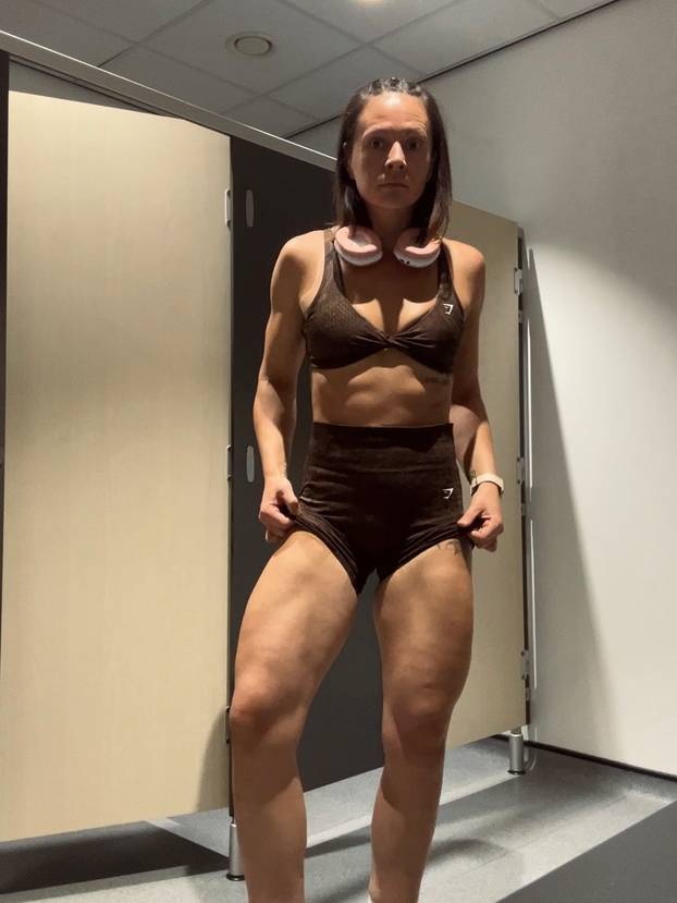 FOTO Smršavjela je gotovo 32 kile u šest mjeseci bez injekcija: Evo kako je to uspjela