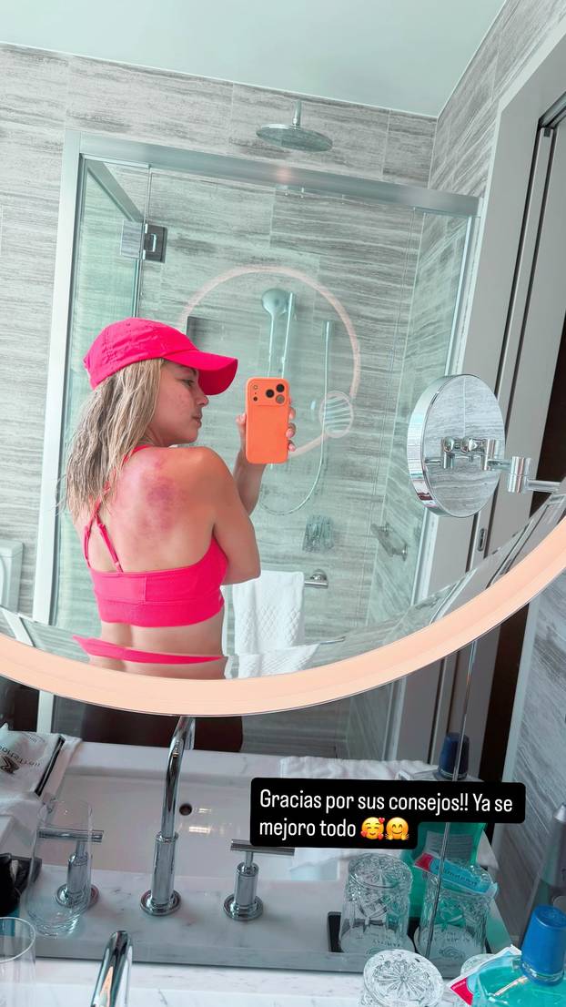 FOTO Tko je tenisačica čija je fotka u toplesu šokirala svijet?