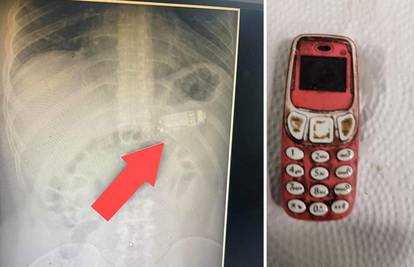 Četiri dana hodao s 'Nokijom 3310' u želucu, izvadili je bez reza: Navodno Snake još radi