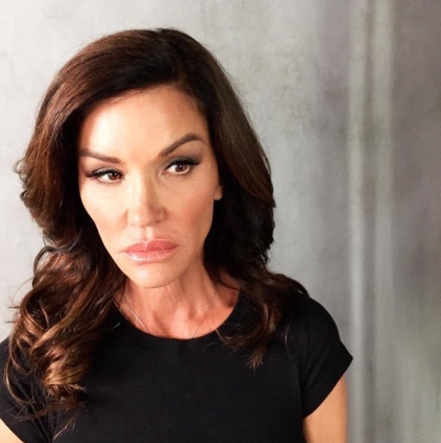 FOTO Bila je jedna od najljepših manekenki, a onda je pala u dugove zbog plastičnih zahvata