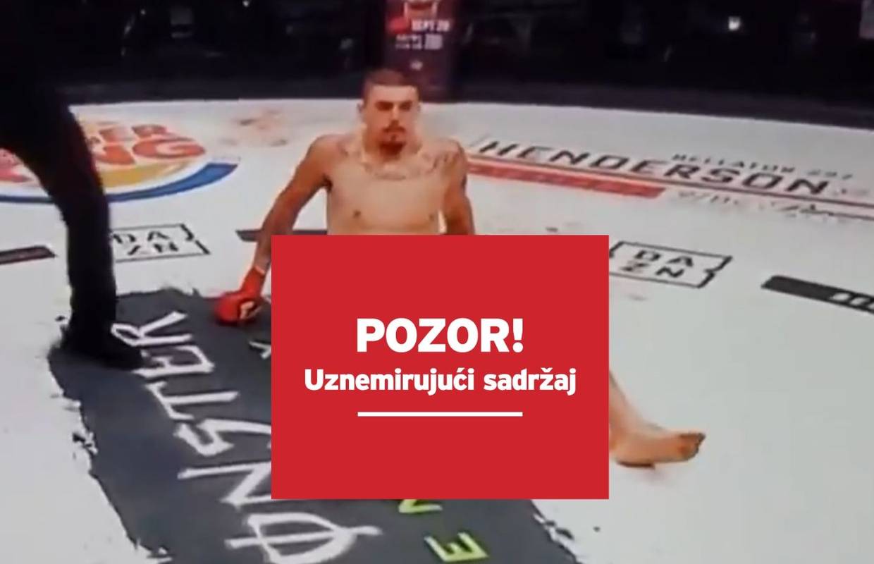 Udario ga i stravično si slomio nogu: Ovo nije za svačije oči...