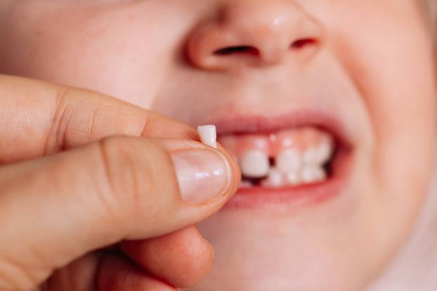 close-up thumb and index finger hold the first fallen baby tooth, the front incisor with the blurred toothless mouth of the child in the background