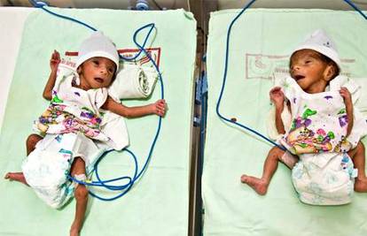 U 70. godini Indijka rodila potpuno zdrave blizance