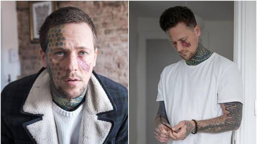 Zbog urođenog madeža na licu borio se s mentalnim zdravljem, a onda je otkrio čari tetoviranja