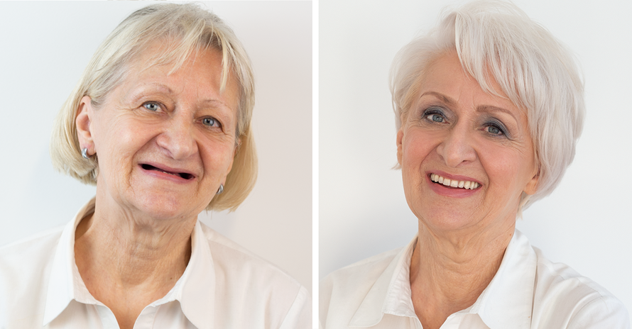 Pogledajte ovu nevjerojatnu promjenu: Nije znala što je čeka