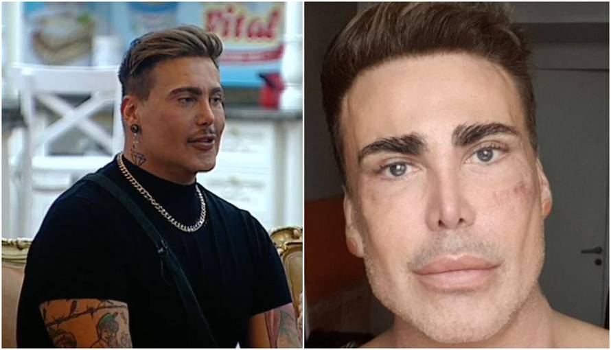 Cigi: 'Koža mi je dosta stradala u realityju pa sam se pomladio'