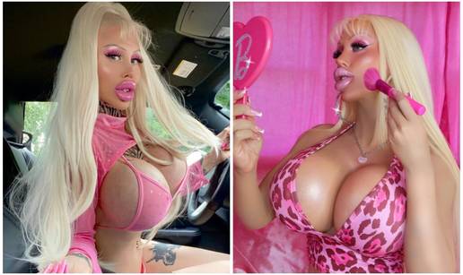 FOTO Amira je ljudska Barbie. Spiskala je 290.000 € na to, a šokirat će vas kako je izgledala!