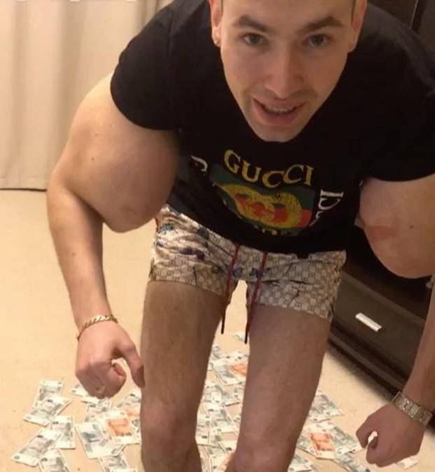 FOTO 'Ruski Popaj' mogao bi izgubiti obje ruke zbog teške infekcije: Ubrizgava kemikalije!