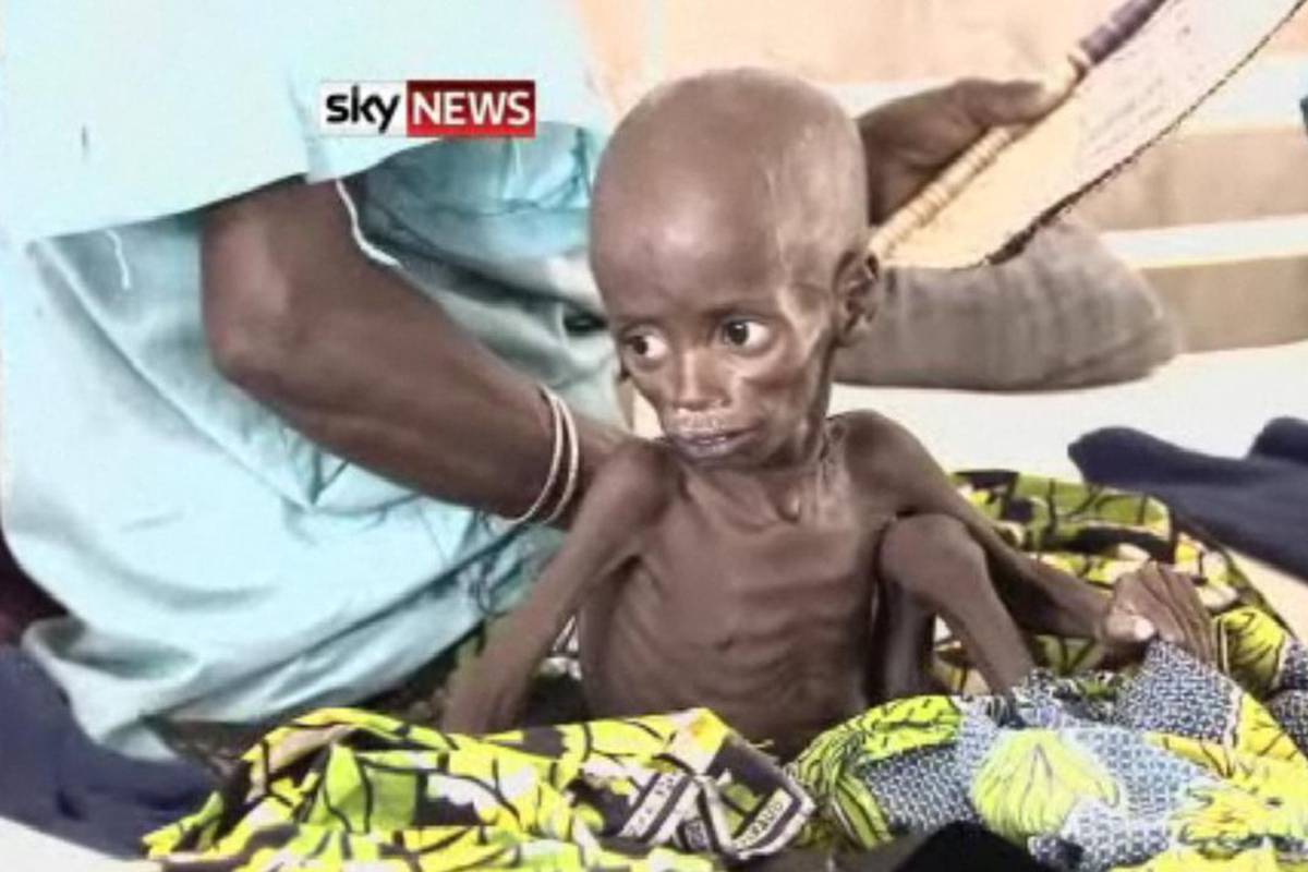 Svako šesto dijete u Africi umre od gladi prije pete godine | 24sata