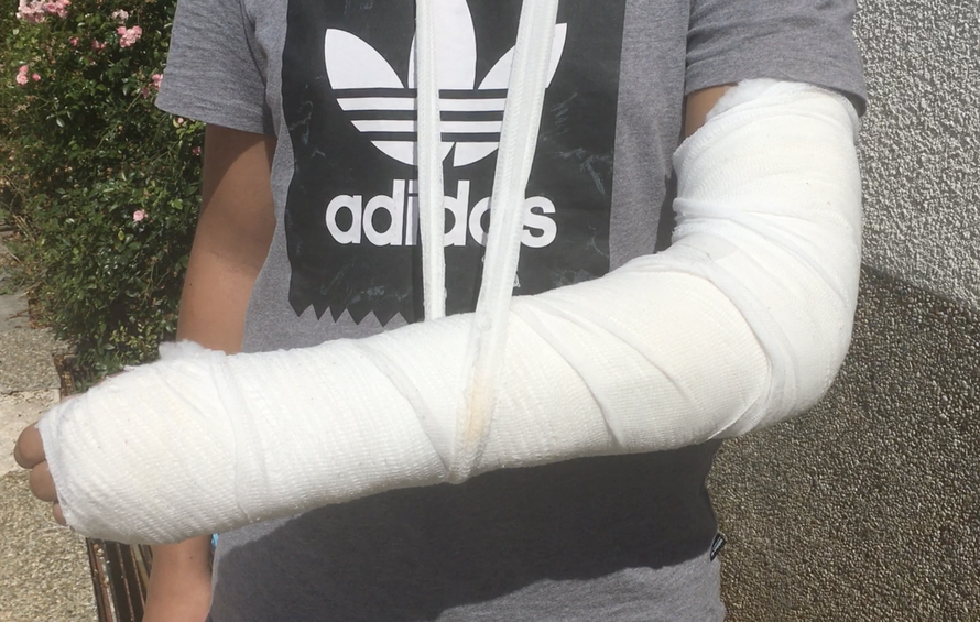 Dječak (14) u šoku: Na vojnika sam ljutit, ne spavam zbog boli