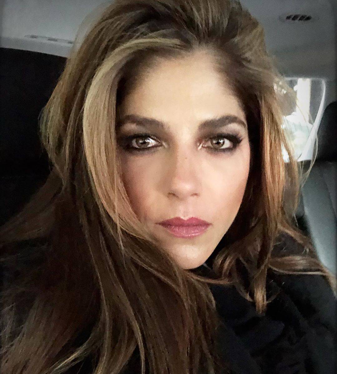 Selma Blair pokazala ranjene noge: 'Bojim se i želim plakati'