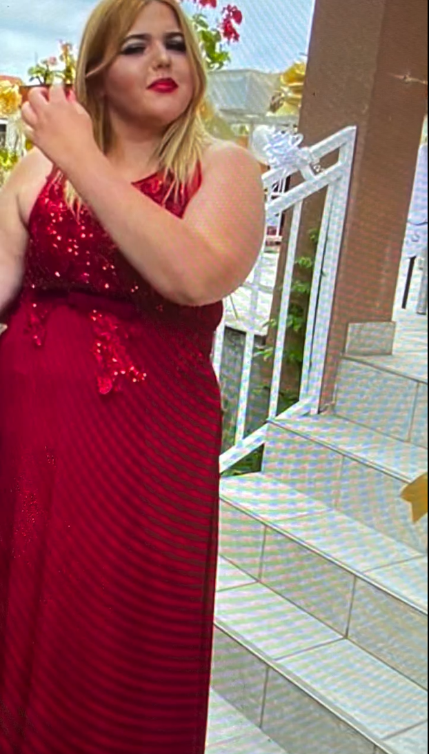 FOTO Missica Antea skinula je 50 kilograma. Pogledajte nevjerojatnu transformaciju