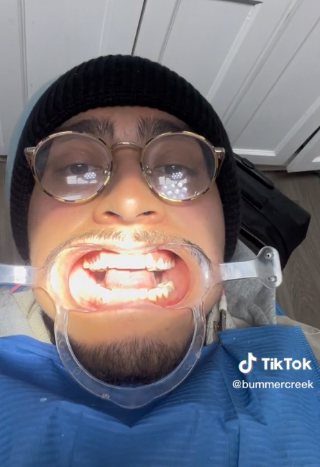 Muškarac se šokirao tijekom posjeta zubaru: 'Na YouTubeu je tražio upute kako popraviti zub'