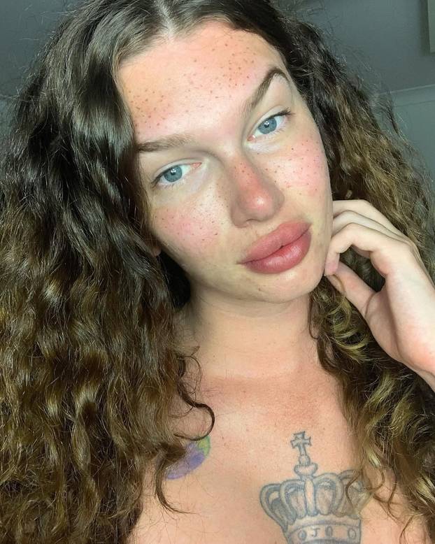 FOTO Htjela je biti žena mačka, a sad plače: Dala sam 7000 €, a fileri su me unakazili! Pomiču se