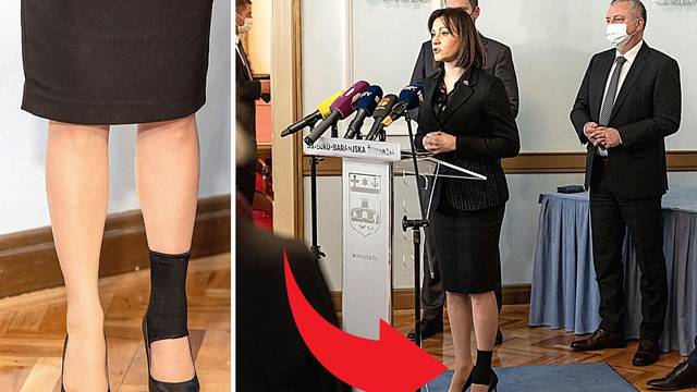 Bilo kuda, sa štiklama svuda: Ministrica u Osijeku nosila visoke pete i elastični zavoj