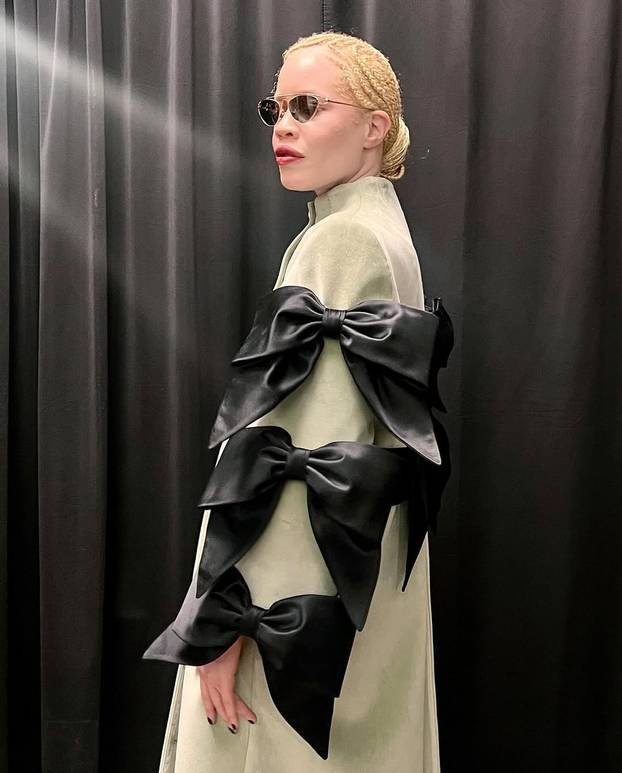 FOTO Afrikanka s albinizmom osvaja modnu industriju: 'Često privlačim znatiželjne poglede'