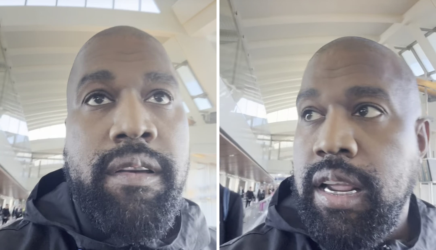 Nakon što je ugradio protezu od titana, Kanye Westu zabrinuo fanove: 'Što ti je to na usni?'
