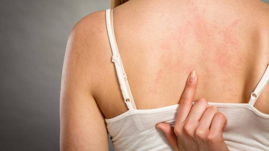 Ovih 7 rizika morate biti svjesni ako unosite previše vitamina C