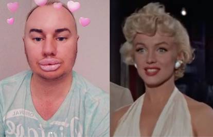 Prošao 20 tretmana: Želim biti kao moj idol Marilyn Monroe