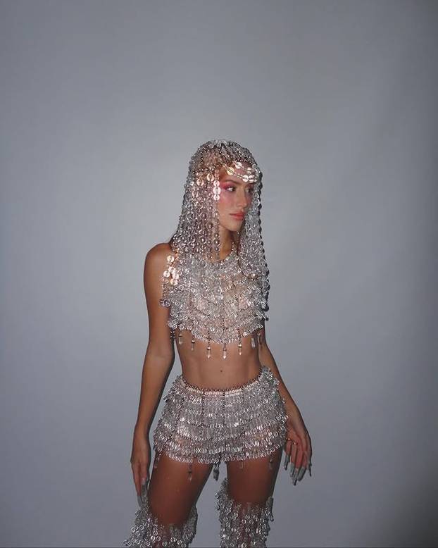 FOTO Posebna ljepota: Milijuni ljudi obožavaju njezine pjegice