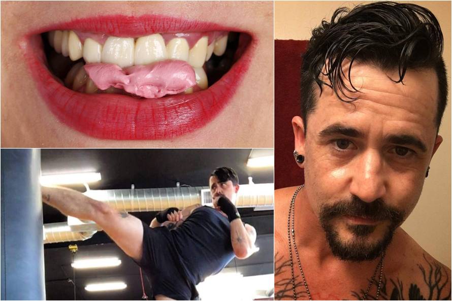 Poludi čim čuje da netko žvače, s obitelji nije pričao godinama