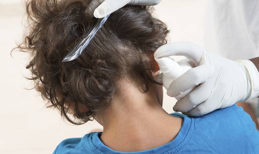 Po&ccaron;ela je sezona u&scaron;iju u kosi: Evo kako ih se u&ccaron;inkovito rije&scaron;iti