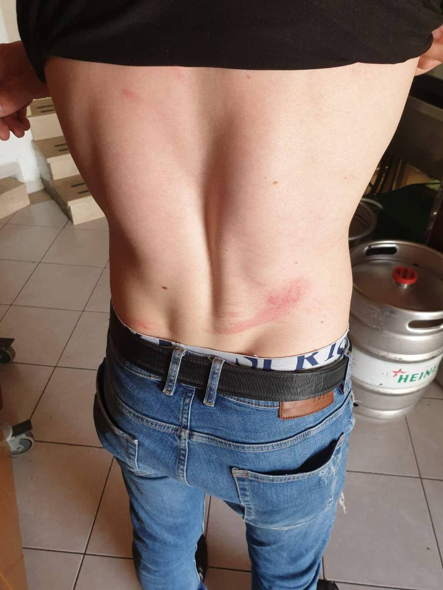 Nasilnici prebili četiri sezonska radnika: Urlali 'Tko je Srbin?!'