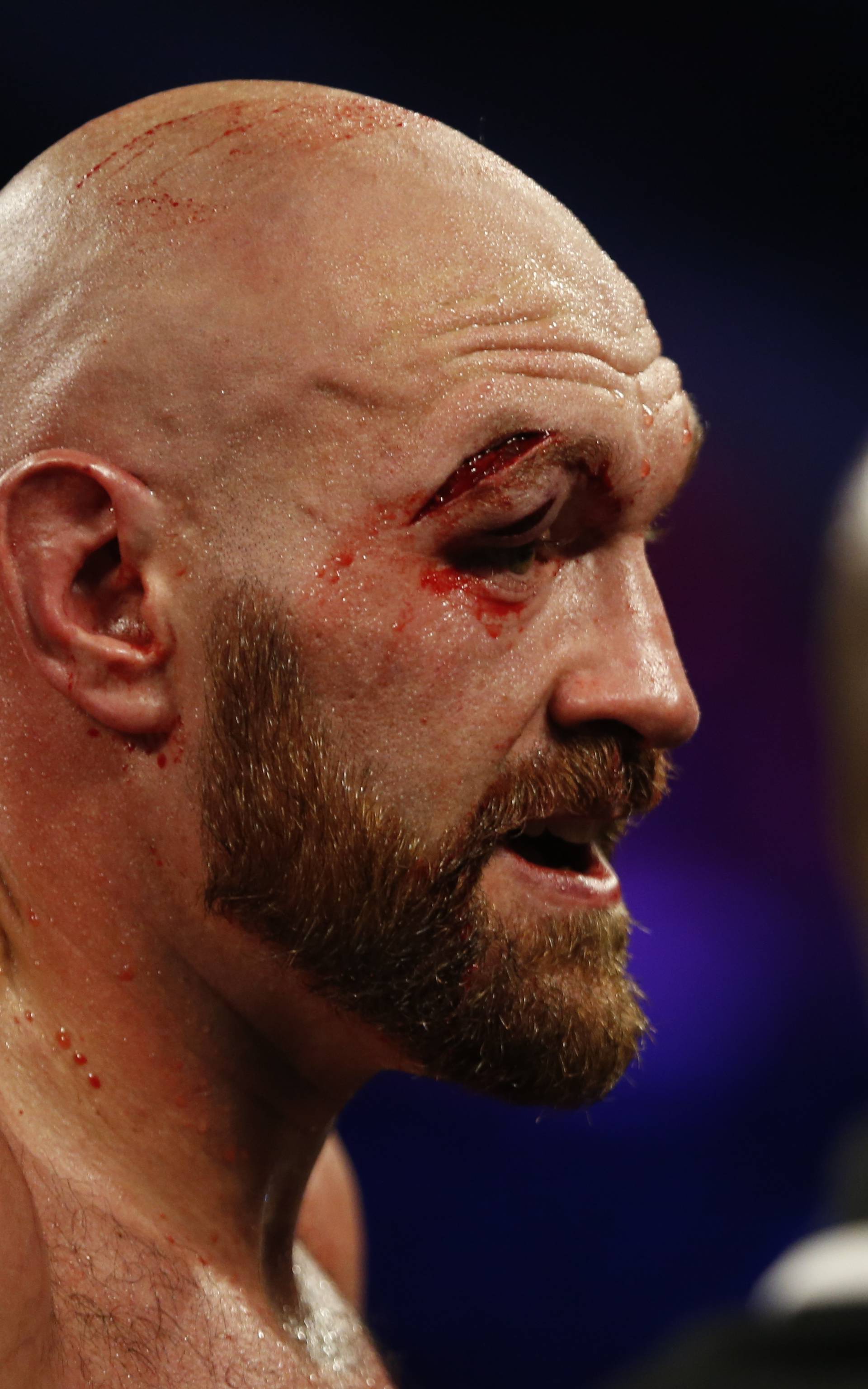 Tyson Fury v Otto Wallin