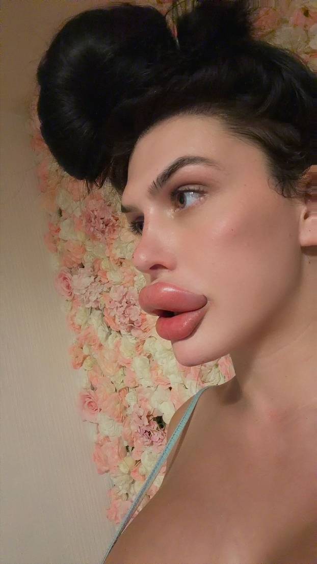 Woman with Britain's ‘biggest lips’ injects filler at HOME after being ‘refused’ by professionals – despite only taking six-week online course