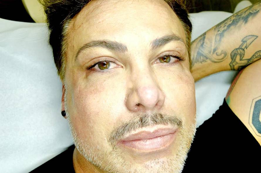 Botoks i silikoni: Popravljaju se Stallone, Ciganović i Travolta...