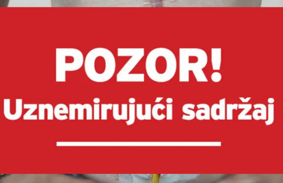 FOTO Pojavila se uznemirujuća fotografija zarobljenika: Urezali su mu 'Slava Rusiji' na trbuh