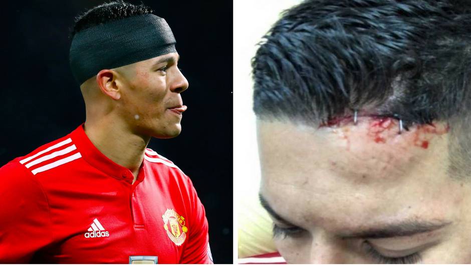 Rojo pokazao 'zakrpanu' glavu nakon mančesterskog derbija...