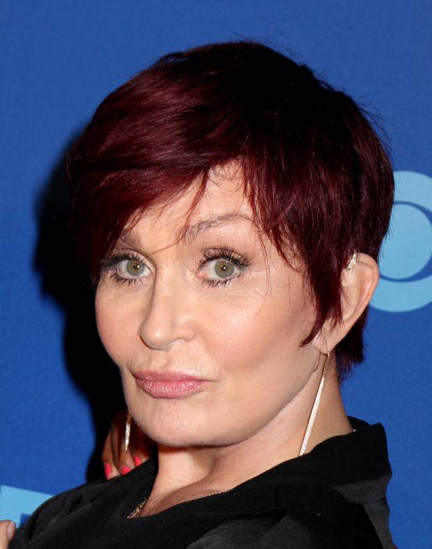 Poznata lica koja su se promijenila zbog velike koli?ine botoksa