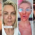 FOTO Ove slavne dame i&scaron;le su pod no&zcaron;: Neke su se 'popravile', druge su imale velikih problema