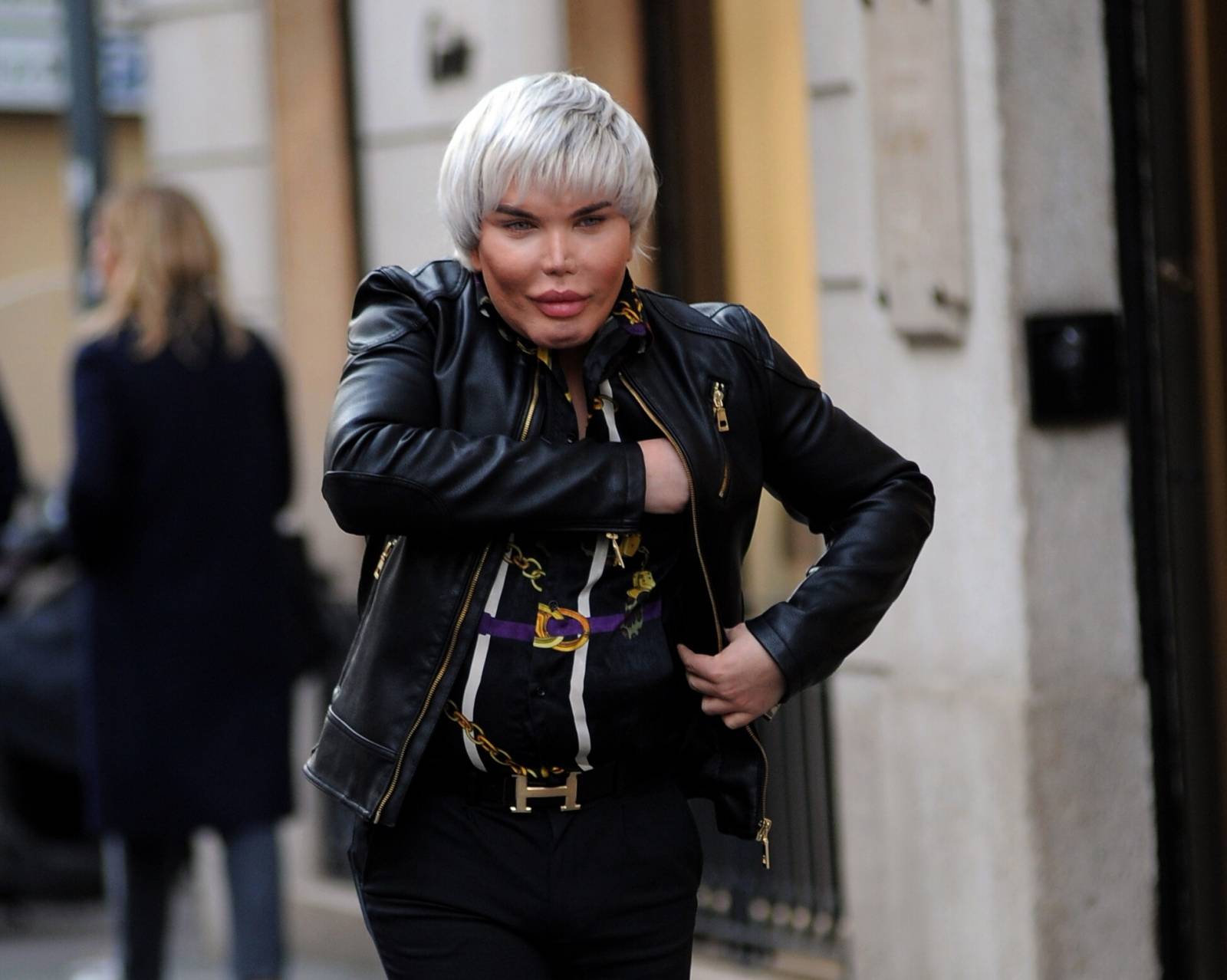 Milan, Rodrigo Alves reappears after operation at the chin