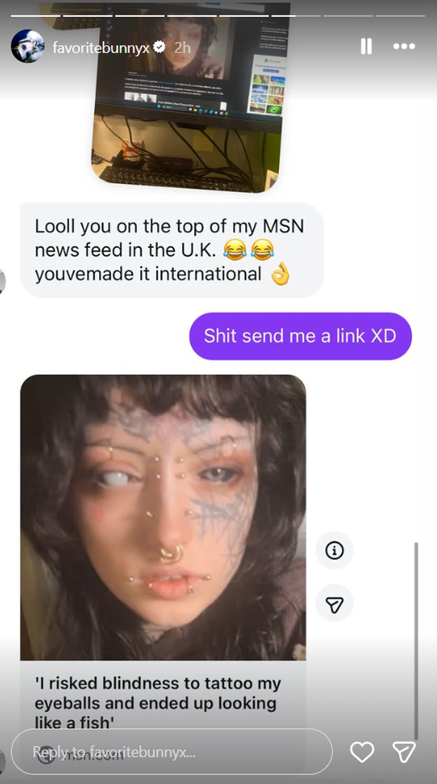 FOTO Djevojka riskirala sljepoću zbog tetovaže očnih jabučica: Izgledam kao riba, ali ne žalim