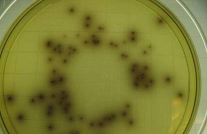 Od dinja zaraženih listeriozom umrlo 13 ljudi, 72 je zaraženih