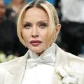 Madonna se protivila estetskim operacijama, sad &ccaron;esto ide pod no&zcaron;: Evo kako se mijenjala